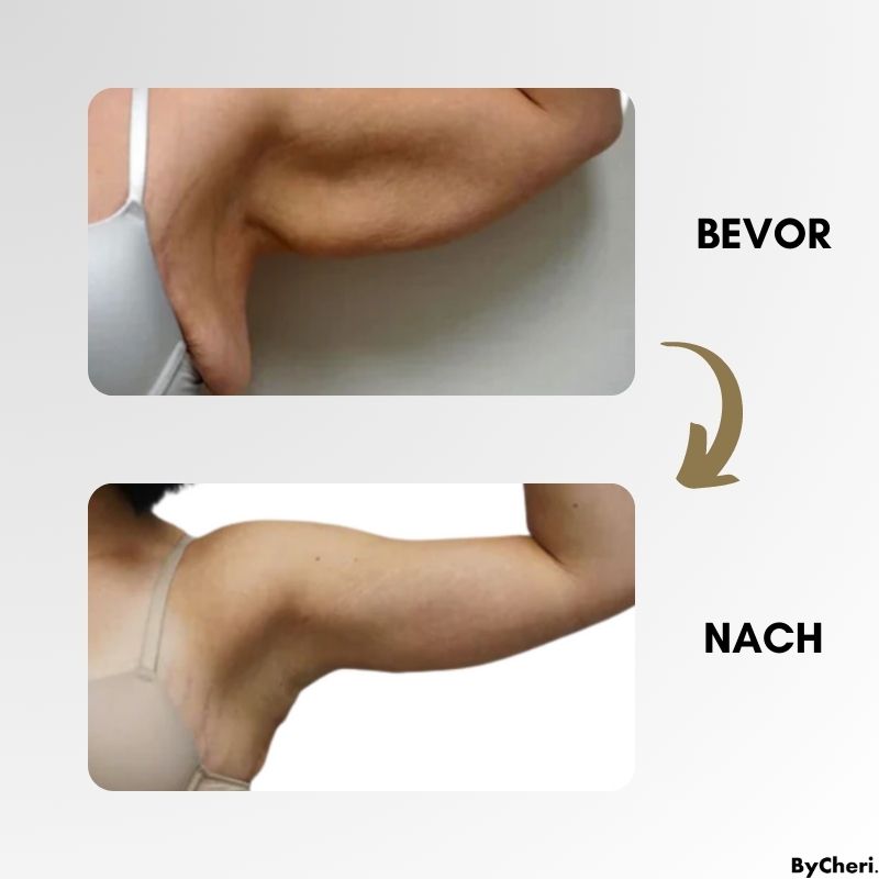 LymphWave™ – Fett verbrennen, Lymphsystem aktivieren