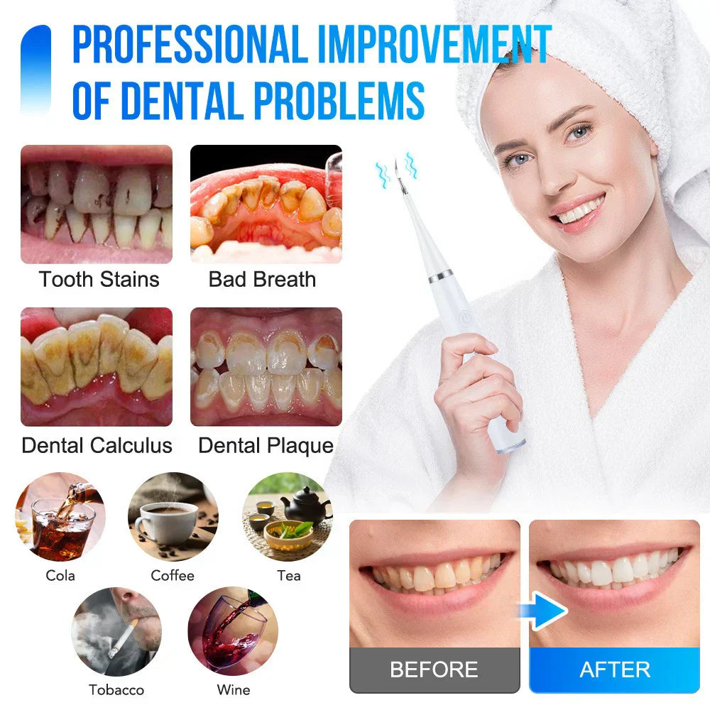 SmilePro™ – Professionelle Zahnreinigung für zu Hause