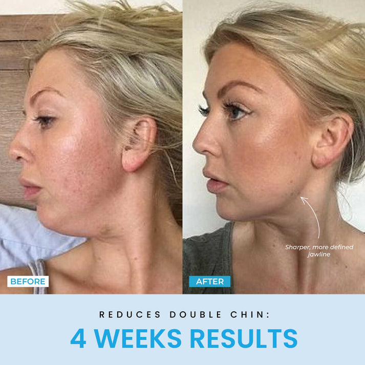 LiftGlow – Dein 5-Minuten-Facelifting für Zuhause