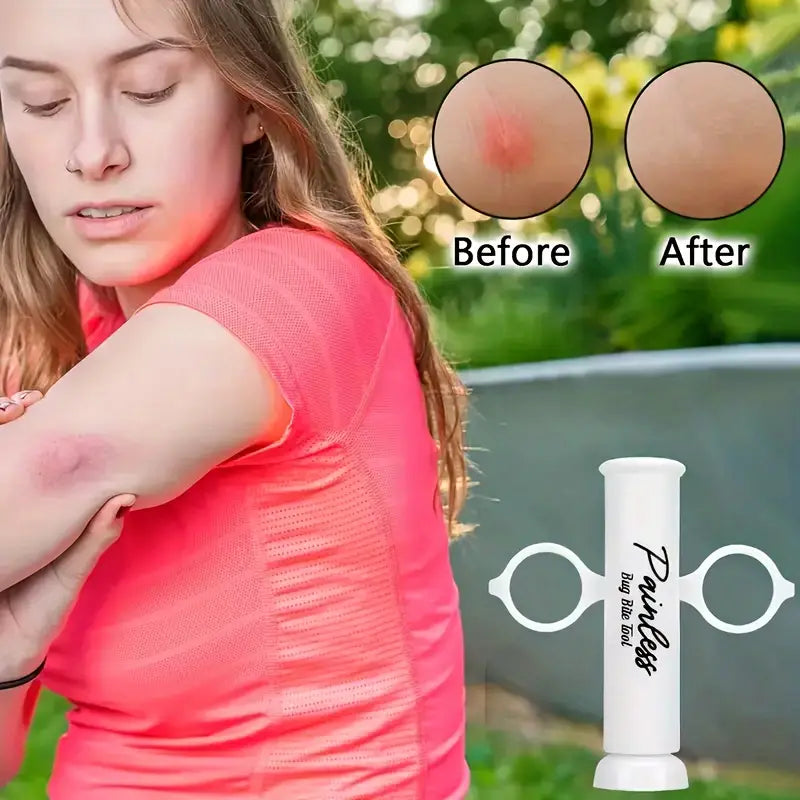BiteAway Pro – Sofortige Linderung bei Insektenstichen