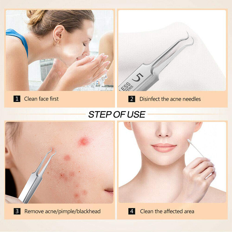 ClearSkin Pro – Sanfte Entfernung von Pickeln & Mitessern